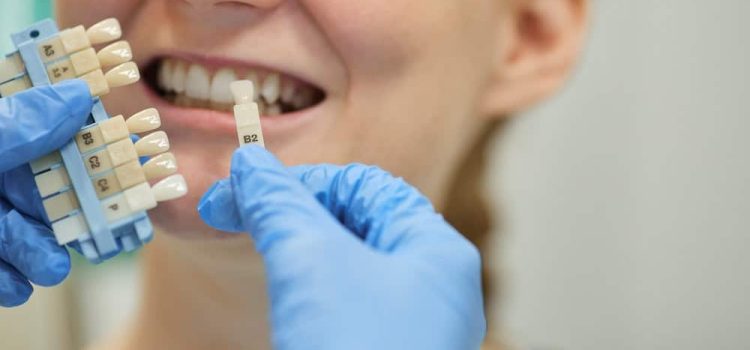 Quelle clinique pour faire des implants dentaires ?